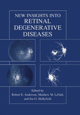 New Insights Into Retinal Degenerative Diseases