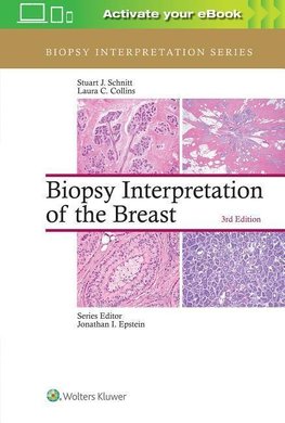 Biopsy Interpretation of the Breast (Biopsy Interpretation Series)