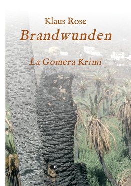 Brandwunden