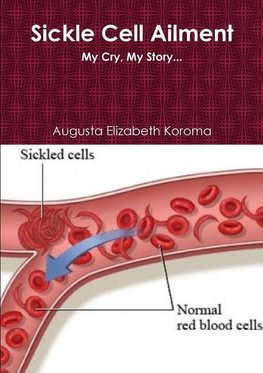 Sickle Cell