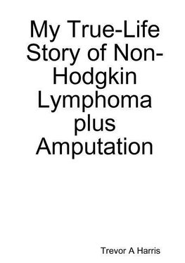 My True-Life Story of Non-Hodgkin Lymphoma plus Amputation