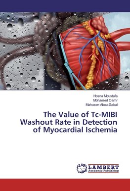 The Value of Tc-MIBI Washout Rate in Detection of Myocardial Ischemia