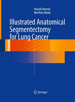 Illustrated Anatomical Segmentectomy for Lung Cancer