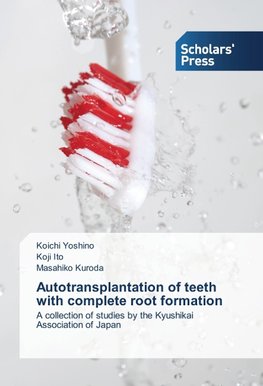 Autotransplantation of teeth with complete root formation