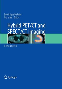 Hybrid PET/CT and SPECT/CT Imaging