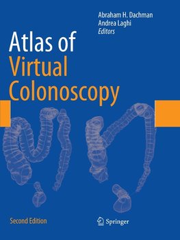 Atlas of Virtual Colonoscopy