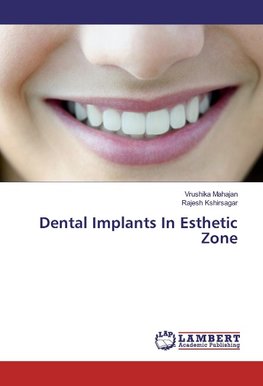 Dental Implants In Esthetic Zone