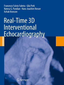 Real-Time 3D Interventional Echocardiography