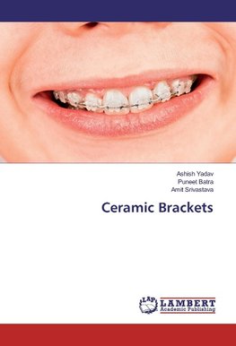 Ceramic Brackets