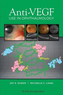 Duker, J:  Anti-VEGF Use in Ophthalmology