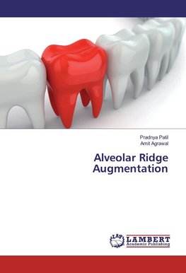 Alveolar Ridge Augmentation