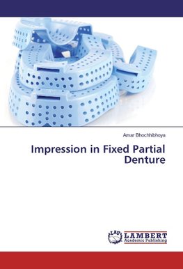 Impression in Fixed Partial Denture