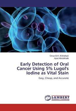 Early Detection of Oral Cancer Using 5% Lugol's Iodine as Vital Stain