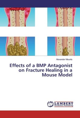 Effects of a BMP Antagonist on Fracture Healing in a Mouse Model