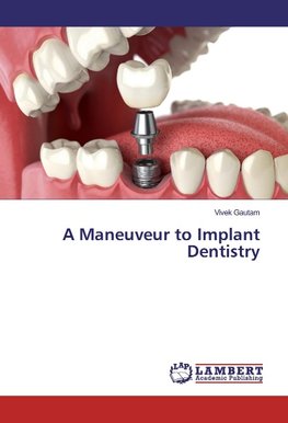 A Maneuveur to Implant Dentistry