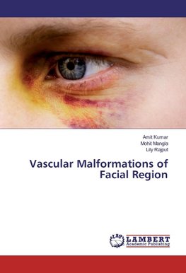 Vascular Malformations of Facial Region