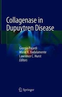 Collagenase in Dupuytren Disease