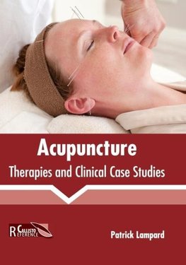 Acupuncture