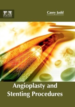 Angioplasty and Stenting Procedures