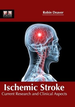 Ischemic Stroke