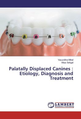 Palatally Displaced Canines : Etiology, Diagnosis and Treatment