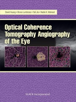 Huang, D:  Optical Coherence Tomography Angiography of the E