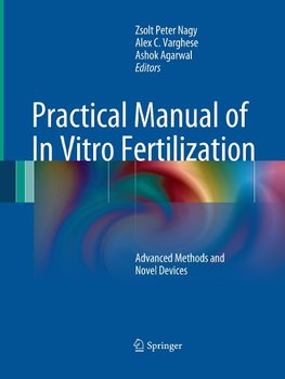 Practical Manual of In Vitro Fertilization