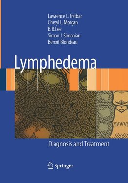 Lymphedema