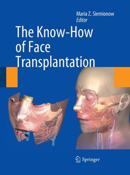 The Know-How of Face Transplantation