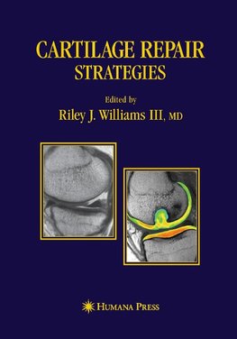 Cartilage Repair Strategies