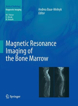 Magnetic Resonance Imaging of the Bone Marrow