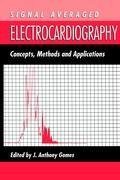 Signal Averaged Electrocardiography