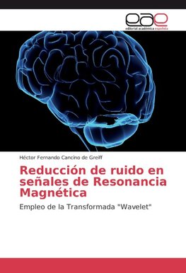 Reducción de ruido en señales de Resonancia Magnética