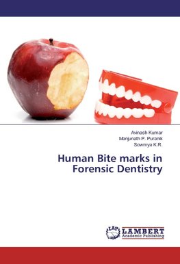 Human Bite marks in Forensic Dentistry