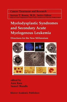 Myelodysplastic Syndromes & Secondary Acute Myelogenous Leukemia