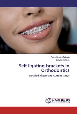 Self ligating brackets in Orthodontics