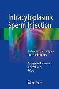 Intracytoplasmic Sperm Injection