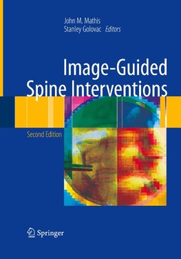 Image-Guided Spine Interventions