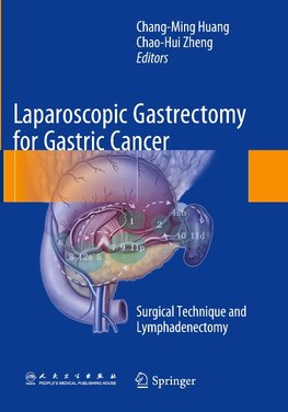 Laparoscopic Gastrectomy for Gastric Cancer