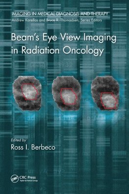 Beam's Eye View Imaging in Radiation Oncology