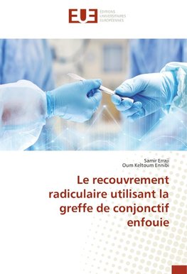 Le recouvrement radiculaire utilisant la greffe de conjonctif enfouie