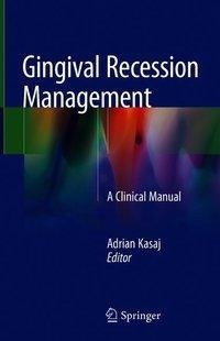 Gingival Recession Management