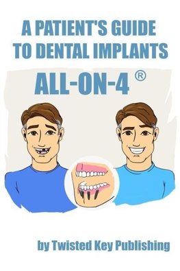 A Patient's Guide to Dental Implants