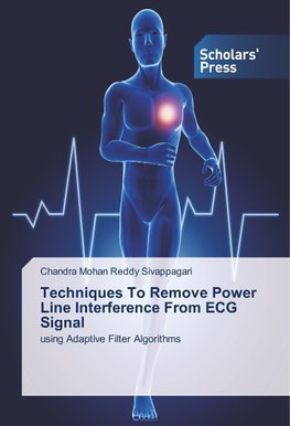 Techniques To Remove Power Line Interference From ECG Signal