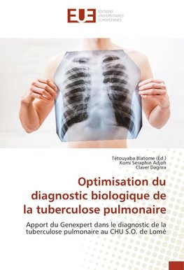 Optimisation du diagnostic biologique de la tuberculose pulmonaire