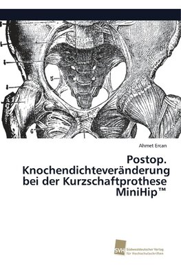 Postop. Knochendichteveränderung bei der Kurzschaftprothese MiniHip(TM)