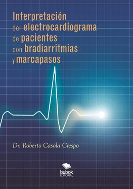 Interpretación del electrocardiograma de pacientes con bradiarritmias y marcapasos