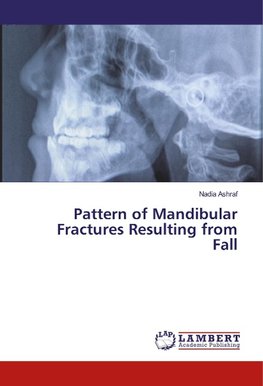 Pattern of Mandibular Fractures Resulting from Fall