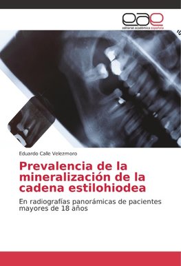 Prevalencia de la mineralización de la cadena estilohiodea