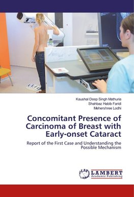 Concomitant Presence of Carcinoma of Breast with Early-onset Cataract